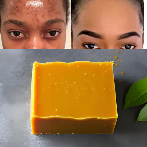 Image of JABON DE CURCUMA / ENVIO GRATIS